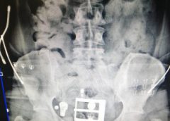 ปฏิบัติการร่วมภายใต้โครงการสกัดกั้นยาเสพติดพื้นที่ท่าอากาศยาน จับโคเคน 1.2 กก.