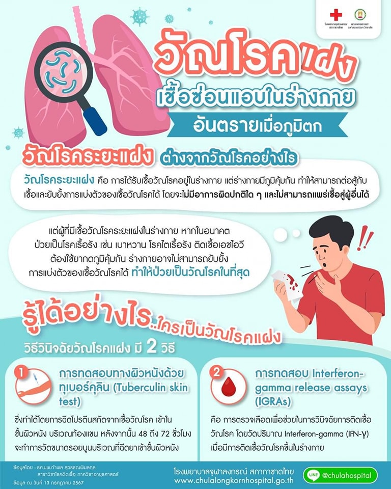 แพทย์ทหาร เตือน “ตรวจหาวัณโรคระยะแฝง” ป้องกันการป่วย ลดการแพร่ระบาดในชุมชน