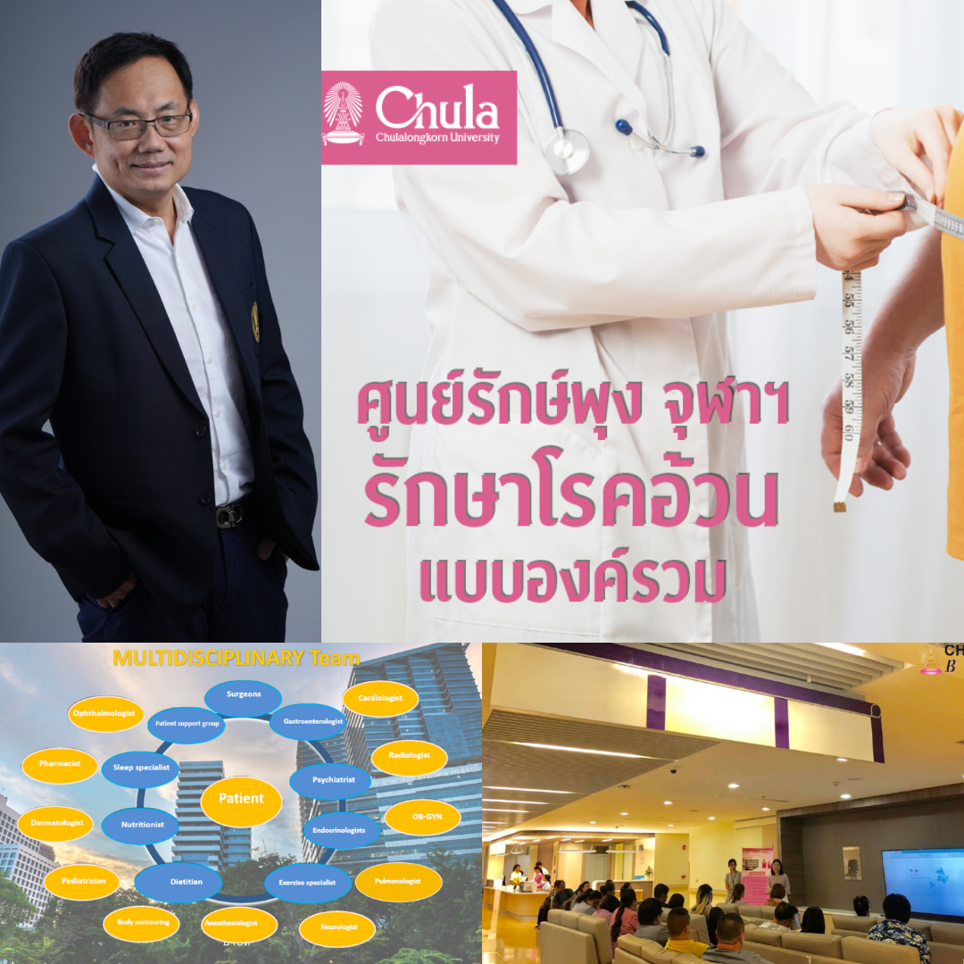 ศูนย์รักษ์พุง จุฬาฯ บริการครบวงจร รักษาโรคอ้วนแบบองค์รวม