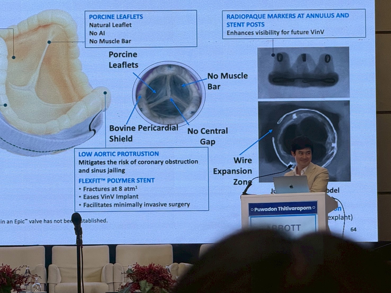 เชิดชูเกียรติศัลยแพทย์หัวใจไทย! นายแพทย์ภูวดล ฐิติวราภรณ์ รับเชิญเป็นวิทยากรพิเศษ ร่วมแบ่งปันนวัตกรรมลิ้นหัวใจระดับประเทศ ในงาน 3rd CMAVC Aortic Valve Expo